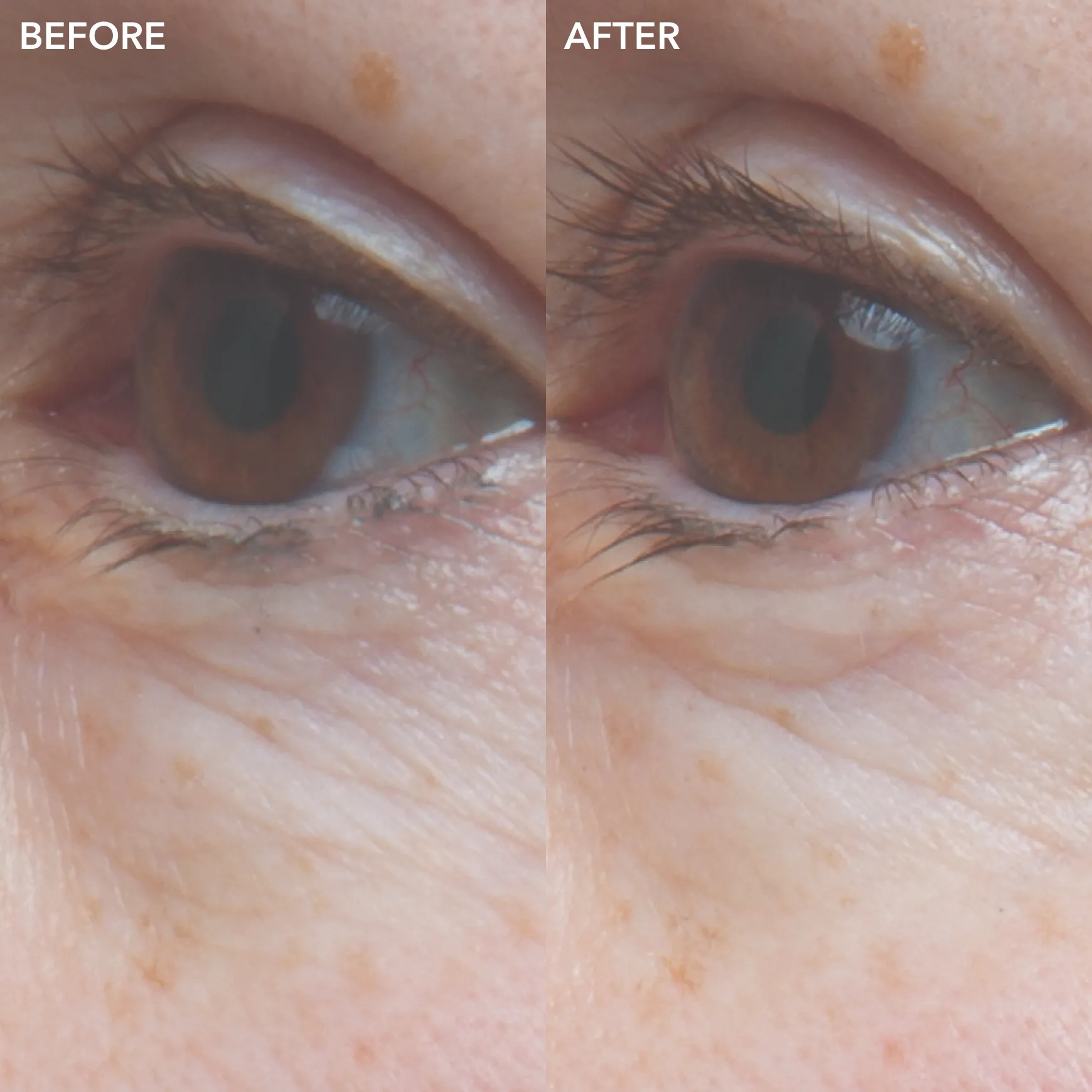GENIUS Ultimate Anti-Aging Eye Cream