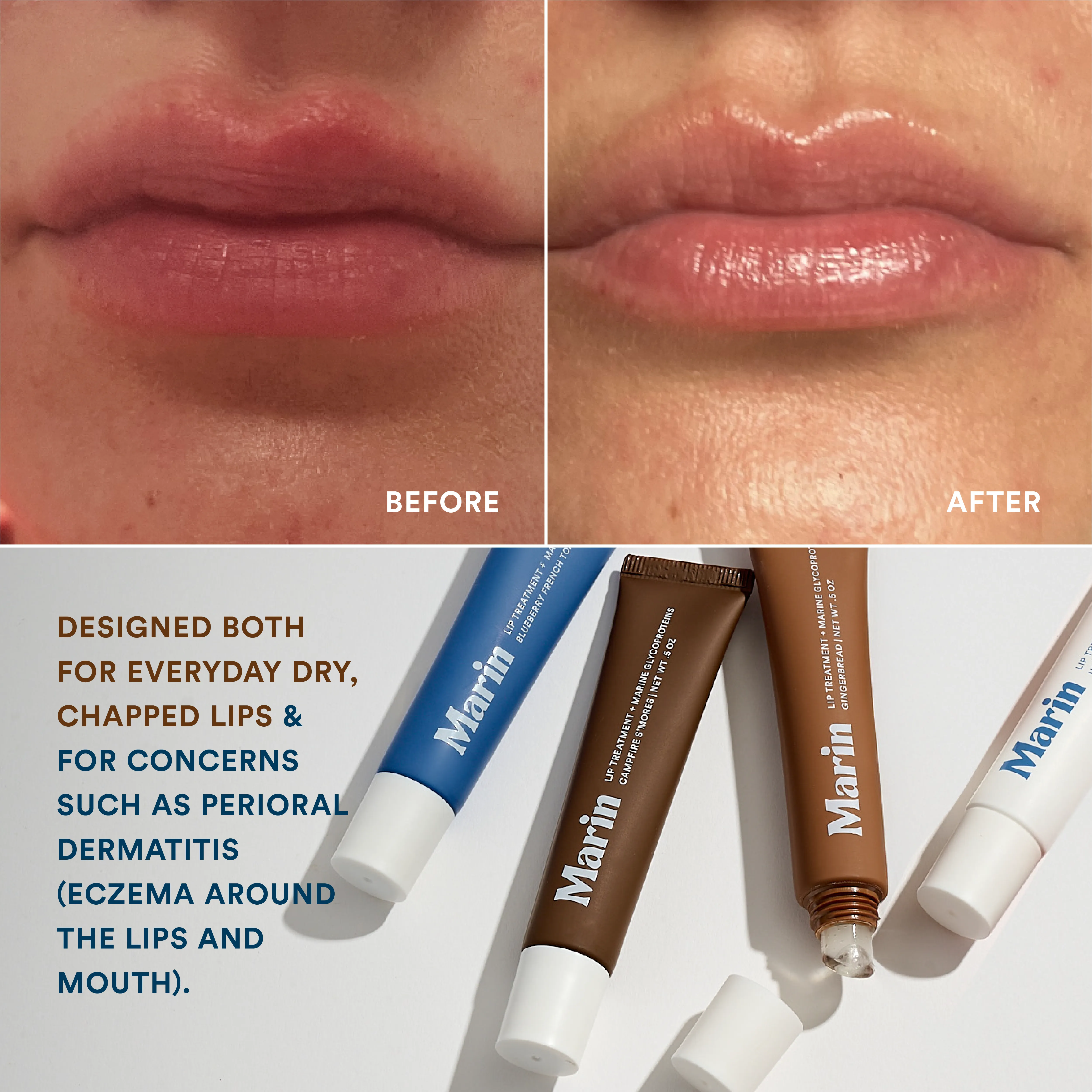 Lip Triple