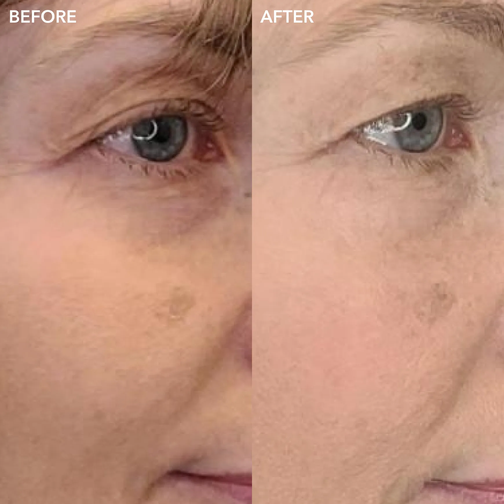 Triple Algae Eye Renewal Balm